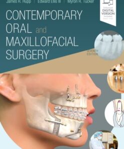 Contemporary Oral And Maxillofacial Surgery 7/e