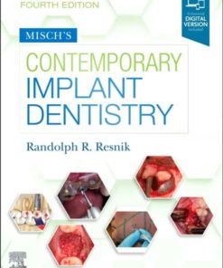Misch'S Contemporary Implant Dentistry