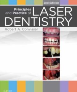 Principles And Practice Of Laser Dentistry
