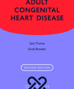 Adult Congenital Heart Disease