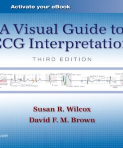 A Visual Guide to ECG Interpretation