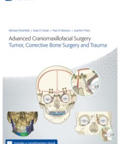 Advanced Craniomaxillofacial Surgery