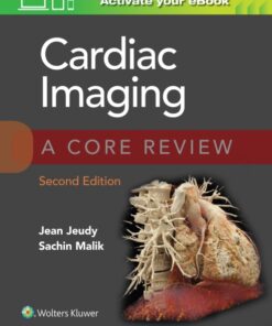 Cardiac Imaging: A Core Review