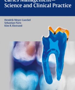 Caries Management - Science and Clinical Practice