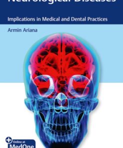 Neurological Diseases: Implications in Medical and Dental Practices