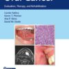 Oral Cancer