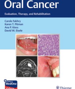 Oral Cancer