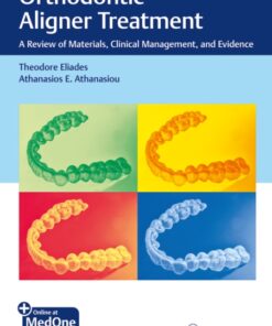 Orthodontic Aligner Treatment: A Review of Materials, Clinical Management, and Evidence