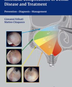 Sinonasal Complications of Dental Disease and Treatment: Prevention - Diagnosis - Management