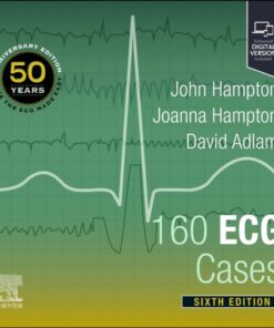 160 ECG Cases