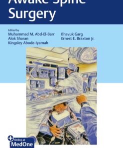 Awake Spine Surgery