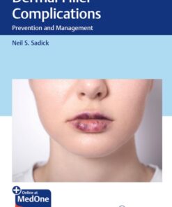 Dermal Filler Complications: Prevention and Management