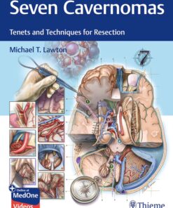 Seven Cavernomas: Tenets and Techniques for Resection