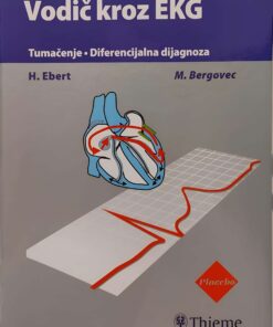 Vodič kroz EKG - Tumačenje, diferencijalna dijagnoza